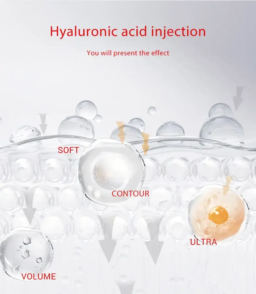 Hyaluronic Acid Dermal Filler